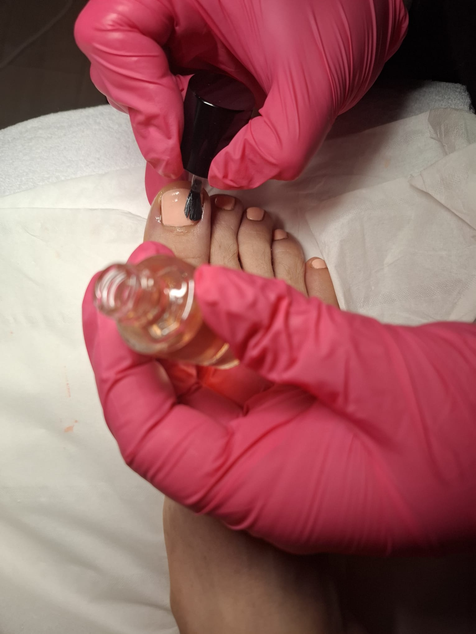 Odstraňování zrohovatělé kůže - profesionální pedikúra Bohumín